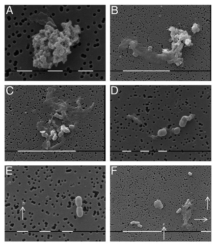 Figure 3. SEM of BCG subpopulation developed after filtration of control suspension: Clusters of granular forms and L-elementary bodies (A) and (B) or disperse single bodies of varied size (C) and (D), small rod shaped bacilli and filterable forms (E) and (F), arrows. Bar = 1µm (a, c, e); 10µm (b, d, f), Bar = 1µm