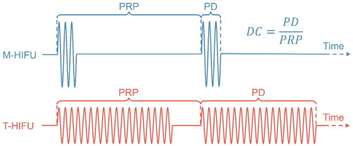 Figure 1. Typical acoustic pressure waveform for mechanical high-intensity focused ultrasound (M-HIFU) and thermal high-intensity focused ultrasound (T-HIFU). PRP: pulse repetition period, PD: pulse duration, DC: duty cycle.