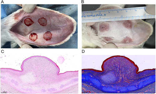 Figure 1 Hypertrophic scar (HS) was established in a rabbit ear. (A) Four 15 mm-diameter circular wounds were created on the ventral surface of each ear by removal of tissue deep to the perichondrium. (B) The gross view of HS in the rabbit ear was observed at 30th day after operation. (C and D) The histopathological appearance of HS was shown by HE staining (×25) and Masson staining(×25) respectively.