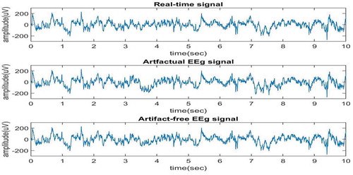 Figure 8. Artifact-free EEG signals using EEMD-SCICA