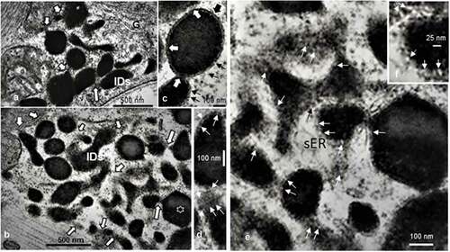 Figure 8. a-d: Example of liposome’s aggregate (Ls) of 45-week-old female obese Zucker tibialis anterior muscle. a and b illustrate the numerous interconnecting bridges or channels appeared (white arrows) as a continuous reticulum contained the electron dense material that extended to the outer membrane of the mitochondria envelopes. In random sections, shapes of Ls varied in a sort of complex topology containing round to elongated ovoid into dodecahedron-like profiles (star) within the smooth endoplasmic reticulum. In c and d: Details of linings (in c, thick and white arrows) appeared and revealed a crenated aspect and, in d, further enlarged views of the same linings in oblique section formed sorts of circular, sieve-like aspect between encased pouch contents (thin white arrows) of similar size as those found ceramide-rich by others in vitro. g: Golgi; m: mitochondria. e-f: TEM enlargements of some parts of 8 b out of the previous pane revealed the crenated lining of the Ls complex (white arrows and a black on channel-like e). In f: micrograph further details demonstrated elongated channel-like, resembling those found in vitro, with phospholipids enriched by ceramides