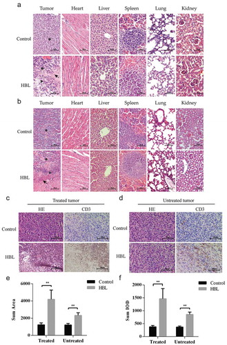 Figure 6. Histological evaluation of tumor tissues and distant organs. (a) The effect of HBL treatment on MC38 tumor tissues and distant organs in C57BL/6 mice. (b) The effect of HBL treatment on HCT116 tumor tissues and distant organs in nude mice. (c) The histological change and T cell infiltration in treated MC38 tumor tissues of the HBL group. (d) The histological change and T cell infiltration in untreated MC38 tumor tissues of the HBL group. (e) Histogram of sum area in T cell infiltration on both sides of MC38 tumor. (f) Histogram of sum IOD (integral optical density) in T cell infiltration on both sides of MC38 tumor. (★ represents tumor cell, ▲ represents inflammatory cells, and ↖ represents necrosis, **p < .01, unpaired student’s t test, data are from the mean with SEM. Red arrows represent the treatment.).