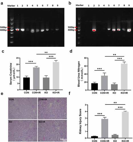 Figure 1. The effects of kidney-specific ALR knockout on renal function and pathological damage in AKI mice. (a, b) Genotype identification of kidney-specific ALR knockout mice. (c) Determination of blood creatinine concentration. (d) Determination of blood urea nitrogen concentration. Representative images (e) and scores (f) of PAS-stained kidney sections. scale bar:100 µm, n = 6–8 mice per group, the bar graph represents the mean ± standard deviation, *P < 0.05, **P < 0.01, ***P < 0.001.