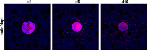 Figure 8. Cell ingrowth into PUR scaffold D from spheroid cultures in vitro. Pre-incubated (24 h) PUR scaffolds were seeded with cell spheroids consisting of 1.5 × 104 human dermal fibroblasts (HDFs) for 24 h, 5 days, and 10 days before staining for actin (red) and nuclei (blue, scale bar 100 μm).