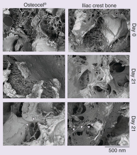 Figure 3. Environmental scanning electron microscopy of stromal cell abundance (Day 0, top panels) and in vitro scaffold colonization (Day 21, middle and bottom panels) in Osteocel® and control iliac crest bone.White filled arrows show cell attachment points to bone, fat cells are indicated by dotted outline and black filled arrows.