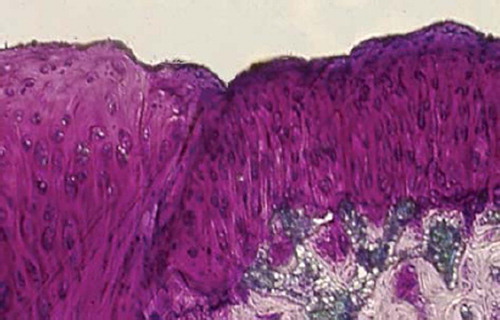 Figures 2. Sagittal sections of cartilage defects transplanted with MSCs derived from bone marrow (1) at 12 weeks (toluidine blue staining × 400).