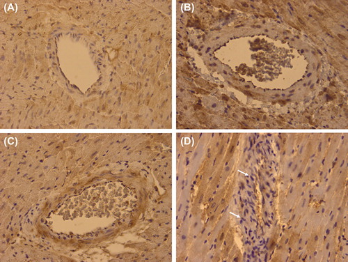 Figure 4. Representative immunohistochemistry for iNOS of a remote intramyocardial artery of a normal heart (A), a graft with ischemia-reperfusion injury only (IRI; B), a graft with ischemia-reperfusion injury and myocardial infarction (IRI + MI; C), and a graft with ischemia-reperfusion injury and myocardial infarction treated with Sildenafil (IRI + MI + S; D) 2 days after reperfusion simulating resuscitation. X40. Note tendency for decreased positive staining (arrows) in a remote intramyocardial artery of a graft with ischemia-reperfusion injury and myocardial infarction treated with Sildenafil (IRI + MI + S) as compared with grafts without (IRI; B) or with infarction (IRI + MI; C).