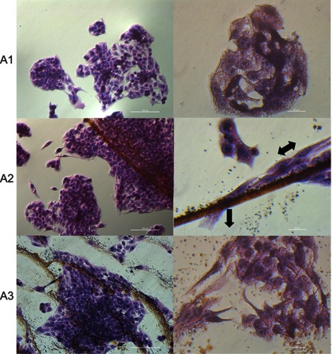 Figure 5 Morphology changes and affinity of HepG2 cells to the C60 nanofilms.Notes: Hematoxylin-eosin staining of HepG2 cells on C60 nanofilms visualized using light optical microscopy. (A1) Control group; (A2) C60-20%; and (A3) C60-100%. Black arrows indicate the direction of cell migration. Scale bars: left pictures 100 μm, right pictures 20 μm.Abbreviation: C60, fullerenes.