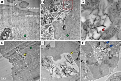Figure 9 Cellular uptake and internalization of nanomaterial observed with TEM.Notes: MCF-7 cells were untreated (A) or treated with PSSG (10 μg/mL) for 3 hours (B and C) and 24 hours (D–F) before TEM examination. As seen in (B) and (C), the nanomaterial was recruited and gathered together near the cell membrane, but outside the cell, showing that no rejection reaction occurred between tumor cells and nanomaterial. In addition, some nanosheets of PSSG were trapped by the pseudopod-like structures and surrounded by cell membrane, which indicates that the cellular uptake of PSSG initiated through the endocytic pathway, while in (D) and (E), the nanomaterial was found inside the phagocytic vesicles in the cytoplasm, showing evident uptake of nanocarriers. Finally, in (F), small amounts of PSSG sheets (blue arrows) escaped from phagocytic vesicles and were released in the cytoplasm. Green and white arrows indicate the cell nucleus and membrane, respectively. Red arrows point to the interface of nanomaterial and cell membrane. Yellow arrows point to the phagocytic vesicles in cytoplasm.Abbreviations: PSSG, PSS-decorated nanographene; PSS, poly(sodium 4-styrenesulfonate); TEM, transmission electron microscopy.