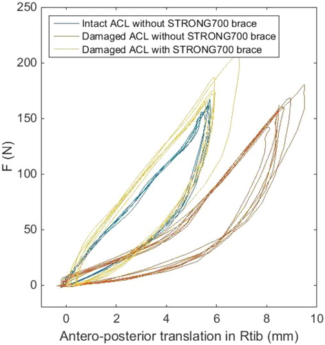 Figure 2. The anterior translation behavior of the surrogate limb under 150 N loading for various configurations.