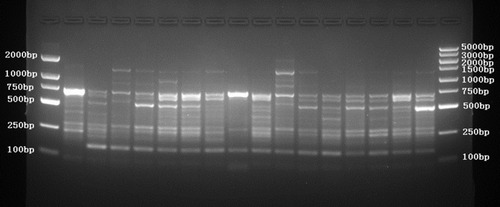 Figure 3 ERIC-PCR DNA fingerprint of 16 CR-hvKP isolates.