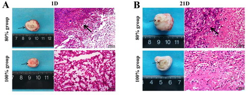 Figure 2. The appearance of tumor tissue damage and the Observation of H&E staining after HIFU ablation in different areas at 1st day (A) and 21st days (B) (the thin black arrow in the tumor tissue refers to the purplish red hyperemic zone surrounding the ablation zone, while the thick arrow in H&E refers to the appearance of tumor ablation junction area, scale bar = 200 μm).