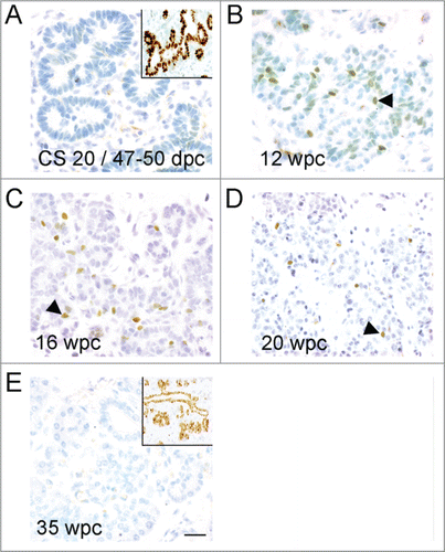 Figure 1. Profile of immunohistochemistry for NEUROG3 during human development. (A–E) Brightfield images show NEUROG3 in brown counterstained with toluidine blue. Insets (A) and (E) show brown SOX9 staining in nearby sections from the same fetus. Arrowheads exemplify positively stained cells. Scale bar represents 50 μm in all panels.