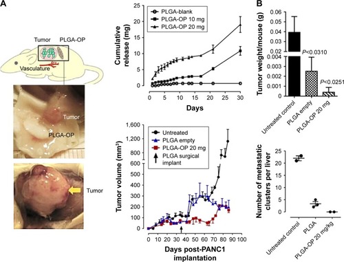 Figure 5 (A) RAGxCγ double-mutant mice bearing heterotopic xenografts of pancreatic PANC1 tumors. (B) Extended release of OP from PLGA-OP surgical implants, measurement of tumor volumes days post implantation, tumor weights at necropsy, and number of liver metastatic clusters.Note: Copyright © 2015. Dove Medical Press. Reproduced from Hrynyk M, Ellis JP, Haxho F, et al. Therapeutic designed poly (lactic-co-glycolic acid) cylindrical oseltamivir phosphate-loaded implants impede tumor neovascularization, growth and metastasis in mouse model of human pancreatic carcinoma. Drug Des Devel Ther. 2015;9: 4573–4586.Citation182Abbreviations: OP, oseltamivir phosphate; PLGA, poly(lactic-co-glycolic acid).