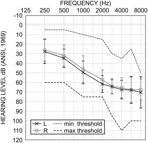 Figure 1. Average participant audiogram (n = 19) for the left (black exes) and right ears (grey circles). Error bars represent one standard deviation of the mean. The maximum and minimum thresholds were shown in dotted and dashed lines respectively.