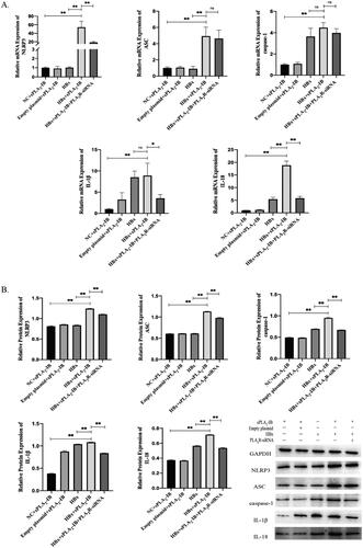 Figure 3. Overexpressed PLA2R activates the NLRP3 inflammasome in podocytes. (A) The mRNA expression levels of the NLRP3 inflammasome and downstream inflammatory factors in each group were determined by qPCR (n = 3). (B) The protein expression levels of the NLRP3 inflammasome and downstream inflammatory factors in each group were determined by WB (n = 3). nsP indicates no significance, *p < .05, **p < .01. The data are presented as the mean ± SD. NC: negative control; siRNA: small interfering RNA; mRNA: messenger RNA; sPLA2-IB: secretory phospholipase A2 group IB, a ligand for PLA2R.