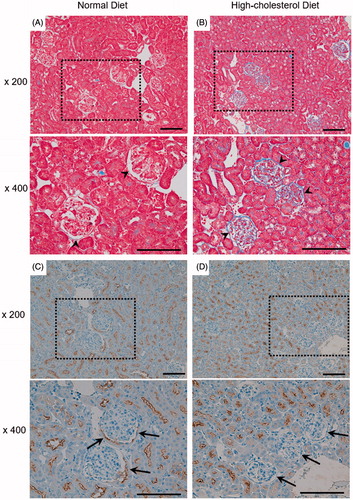Figure 1. Histological examination of mouse kidney. Male C57BL/6 mice were fed a normal diet (ND; A,C) or high-cholesterol diet (HCD; B,D) for 11 weeks. (A,B) Representative micrographs showing Masson’s trichrome staining. Arrowhead: Bowman’s space. (C,D) Representative micrographs showing immunostaining with megalin (proximal tubule marker, dark staining). Arrow: tubular epithelium lining of the proximal tubules which are contiguous with Bowman’s capsule. Box area is enlarged to compare HCD with ND (lower panels). Scale bars: 50 μm.