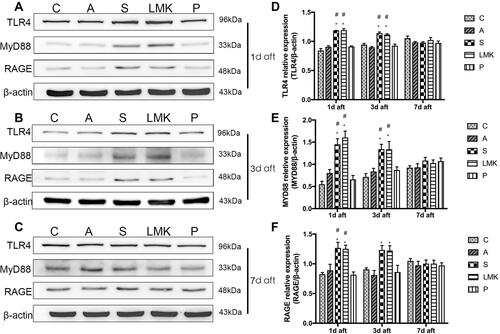 Figure 8 TLR4 and RAGE play a critical role in HMGB1-mediated neuroimmune activation. (A–C) Representative Western blots of TLR4, MyD88, and RAGE on postoperative day 1, 3, and 7, n = 4 per group. Each sample repeated the experiment 3 times. (D–F). Densitometric analysis of Western blot data from (A–C), n = 4 per group. #p < 0.05 versus the day-matched control group. *p < 0.05 versus the day-matched anesthesia group.