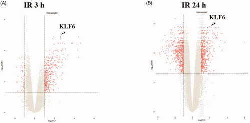 Figure 1. Volcano plot graph illustrating the differential abundant proteins in the quantitative analysis. The − log10 (p value) was plotted against the log2 (ratio IR/control). The black dots represented proteins level dysregulated in IR samples, Arrows indicated the KLF6 upregulation in IR samples.