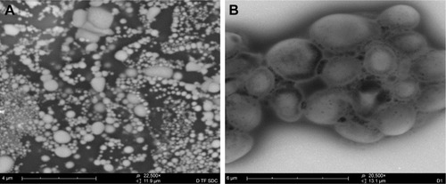 Figure 1 Transmission electron microscopic analysis of the morphology of the LNPs. (A) At a magnification of 22,500×; (B) at a magnification of 20,500×.Abbreviation: LNPs, lipid nanoparticles.