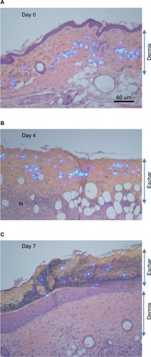 Figure 2 Histology of tattoo sites before and after ingenol mebutate treatment.