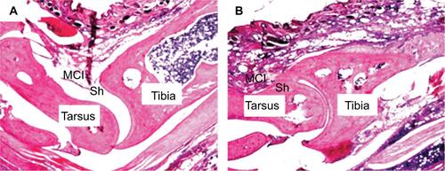Figure S1 CFA-induced histopathological alterations in the tibiotarsal joint.Notes: Two days after saline or CFA injection in the right tibiotarsal joint, the rats were sacrificed and the right tibiotarsal joints were fixed, sectioned, and subjected to HE staining. A representative histological image of a section of tibiotarsal joint from a sham rat (A) and a CFA rat (B) (40× magnification).Abbreviations: CFA, complete Freund’s adjuvant; HE, hematoxylin–eosin; MCI, mononuclear cell infiltration; Sh, synovial cell lining hyperplasia.