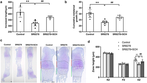 Figure 7. Restraint of MAPK-ERK1/2 abrogated SR8278-inhibited longitudinal elongation of metatarsal bone. Metatarsal bone was extracted from 0 day-old mice and cultured in serum-free MEM medium containing SR8278 or SCH772984 (SCH). (a,b) Bone length was measured at the beginning and at the end of the 3-day culture using an eyepiece micrometer in a dissecting microscope (n = 8). (c) Toluidine blue staining of control, SR8278 and SR8278+ SCH metatarsal bone. Scale bars:100 μm. (d) The height of resting zone, proliferative zone and hypertrophic zone from control, SR8278 and SR8278+ SCH metatarsal bone (n = 6). RZ: Resting zone, PZ: Proliferative zone, HZ: Hypertrophic zone. Data are presented as mean ± SD (One-way ANOVA; VS. control, *P < 0.05, **P < 0.01, VS. SR8278, #P < 0.05, ##P < 0.01).