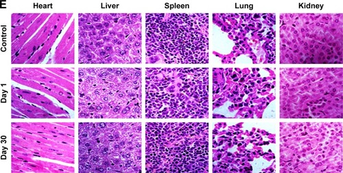 Figure 12 In vivo biocompatibility.Notes: (A) Body weight of 4T1 tumor bearing mice after various treatments. Blood biochemistry (B) and blood cells count (C, D) of mice at days 1 and 30 posttreatment with saline (control) and PTX-GHP-VEGF. (E) H&E-stained tissue sections of major organs, including the heart, liver, spleen, lung, and kidney from mice treated with saline (control) or PTX-GHP-VEGF at day 1 and day 30 (magnification: 100×).Abbreviations: PTX, paclitaxel; VEGF, vascular endothelial growth factor; NIR, near infrared; H&E, hematoxylin and eosin; WBC, white blood cells; RBC, red blood cells; HGB, hemoglobin; HCT, hematocrit; MCH, mean corpuscular hemoglobin; MCHC, mean corpuscular hemoglobin concentration; MCV, mean corpuscular volume; MPV, mean platelet volume; PLT, platelets; AST, aspartate transaminase; ALT, alanine transaminase; GHP, GO-HSA-PEG.