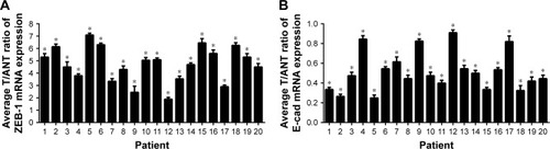 Figure 2 The relative expression levels of ZEB-1 and E-cadherin mRNA.