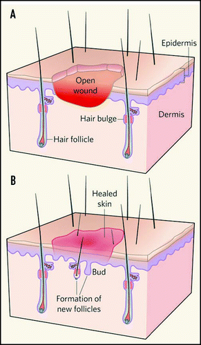 Figure 6 Involvement of Wnt signaling in the de novo regeneration of skin appendage organs. (a) Large open wounds in mouse skin become reepithelialized. (b) Skin appendages are generated from the center of wounds that are 1.0 cm in diameter or larger. Wnt signaling during wound healing increased the number of hair follicles induced in during wound healing. The figure is taken from Chuong.Citation90