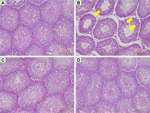 Figure 4 Thickness of seminiferous tubule in STZ-induced diabetic rats: (A) Con, (B) DM, (C) Nano-PAC5, and (D) Met.Notes: The testis sections were stained with H&E. The yellow arrow indicates the changes in the seminiferous tubule.Abbreviations: STZ, streptozotocin; Con, control; DM, diabetes mellitus; Nano-PAC5, diabetes+20 mg/kg per day Nano-PAC; Met, diabetes+300 mg/kg per day metformin; Nano-PAC, PAC encapsulated in silica–chitosan nanoparticles; PAC, petri dish-cultured Antrodia cinnamomea.