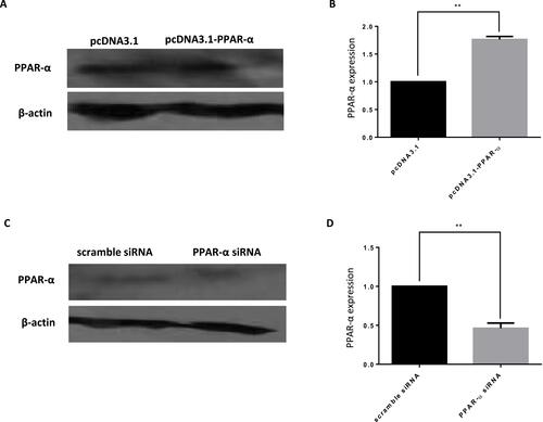 Figure 10 Target gene verification of miR-21 (A–D) Detection of the expression of PPAR-α by Western blotting. As compared with the expression levels of endogenous PPAR-α in the HTR-8/SVneo cells transfected with pcDNA3.1, pcDNA3.1-PPAR-α, scramble siRNA, and PPAR-α siRNA. n = 3 per group. **P<0.01.