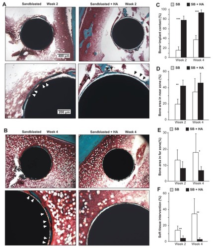 Figure 9 Nanopolymorphic crystalline hydroxyapatite-enhanced periimplant bone generation. (A and B) Representative histological images of the sandblasted and sandblasted + hydroxyapatite-coated implants with Goldner’s trichrome stain at weeks two and four postimplantation. Average histomorphometric values of (C) bone– implant contact, (D) bone area in near zone, (E) bone area in far zone, and (F) soft tissue intervention are shown (n = 6).Notes: *P < 0.05; **P < 0.01; ***P < 0.001, indicating a statistically significant difference between the two surfaces.Abbreviations: HA, hydroxyapatite; SB, sand blasted.