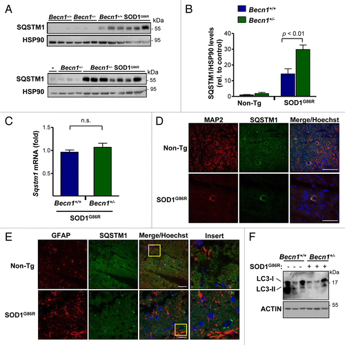 Figure 4. Altered levels of autophagy markers in transgenic SOD1 mice heterozygous for Becn1. (A) Levels of SQSTM1 were monitored in spinal cord extracts of symptomatic SOD1G86R transgenic mice by western blot and quantified by densitometry. Each lane represents a single mouse, ordered by genotype and then by life span (incremented values). “*” represents the same sample from the first lane of a Becn1+/+ SOD1G86R mouse shown in the left gel used as a normalization sample. (B) SQSTM1 levels were quantified from samples described in (A). Statistical analysis was performed using a one-way ANOVA test; data represent mean and standard error of at least 4 independent animals per genotype. (C) Sqstm1 mRNA levels were measured by real-time PCR in samples presented in (A). Mean and standard error is shown. n.s., nonsignificant differences. (D) Immunofluorescence analysis of SQSTM1 (green) and MAP2 staining (neuronal marker, red) or (E) SQSTM1 and GFAP staining (astrocytes, red) was performed in spinal cord tissue derived from SOD1G86R and non-transgenic littermate control mice (Non-Tg). Hoechst staining was also performed (blue). A merged image of the triple staining is presented together with a zoom of the selected area (yellow square). A representative image is presented of the analysis of 3 independent animals for genotype. Scale bars: 10 µm. (F) Levels of LC3-I and II were evaluated by western blot in spinal cord samples from Becn1+/+ SOD1G86R and Becn1+/− SOD1G86R mice. The western blot for LC3-I and II was performed in a 17% SDS-PAGE. Each well represents an independent animal analyzed.