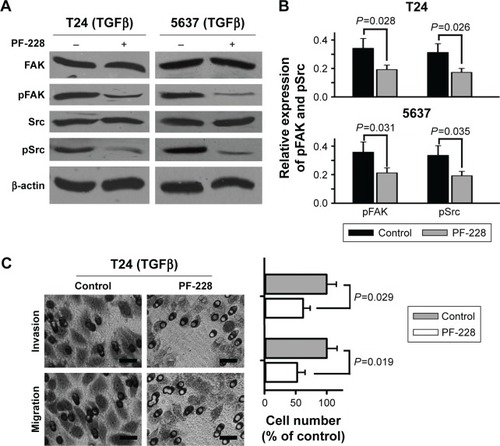 Figure 3 Suppression of FAK phosphorylation reduces TGFβ-induced migration and invasion of bladder cancer cells.