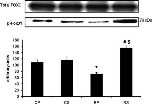 Figure 5  The effect of restraint and Sutherlandia supplementation on FKHR phosphorylation in gastocnemius muscle. Samples were analysed by western blotting with antibodies recognizing phospho- and total FKHR. Results are expressed as means ± SEM for eight independent experiments, *p < 0.001 vs. CP; #p < 0.01 vs. RP, $p < 0.01 vs. CS, F = 20.59. CP, control placebo; CS, control Sutherlandia; RP, restraint placebo; RS, restraint Sutherlandia.