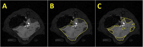 Figure 8. Illustrative picture of original magnetic resonance images of a rat abdominal cavity (A) with outlined liver (B) and ischemic areas within the liver tissue (C) after transplantation of 1000 syngeneic pancreatic islets using the MRI contrast agent to enhance the difference in the signal intensity of well-perfused and non-perfused liver tissue.