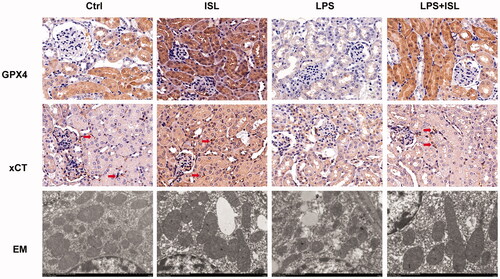 Figure 4. ISL increased the expression of GPX4 and xCT then attenuated mitochondria injury in renal tubular following LPS injection in mice. A total of 30 mice were randomly divided into six groups (n = 5): control, ISL, Fer, LPS, LPS plus ISL, and LPS plus Fer. An intraperitoneal injection of LPS (10 mg/kg) was made to induce septic AKI. ISL was administered via gavage at 50 mg/kg 30 min before LPS injection. Immunohistochemical staining in mice to detect GPX4 and xCT. And mitochondria analysis with scanning electron microscope. Magnification for immunohistochemical staining: ×400.