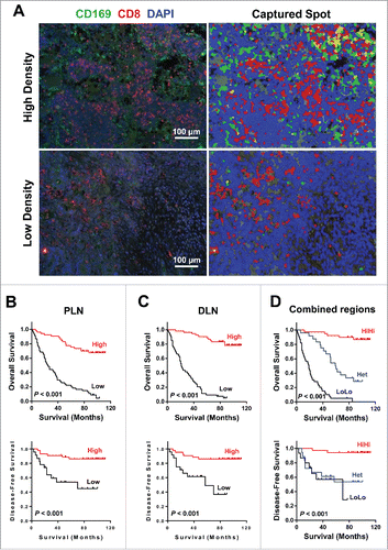 Figure 4. Prognostic significance of CD169+CD8+ T cells in CRC patients. (A) (Left) A representative example of CD169 and CD8+ immunofluorescence staining of a tumor-draining LN section from CRC patients. CD8+ T cells (red), CD169 cells (green), and nuclei (blue) are shown. (Right) Digital image analyzed with the Nuance image software. (B–D) Cumulative OS and DFS times were calculated by the Kaplan–Meier method and analyzed by the log-rank test. The patients were divided into two groups according to the median value of CD169+CD8+ T cells in peri-LN (B), distant-LN (C), and combined regions (D).