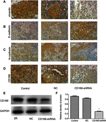Figure 6 Expression of CD166 and EMT-related protein of nude mice xenograft model with the downregulation of CD166. (A–C) IHC suggested that E-cadherin was upregulated, while N-cadherin and vimentin were downregulated (magnification, ×200). (D) CD166 expression of nude mouse xenograft model identified by IHC. (E and F) CD166 expression of nude mouse xenograft model identified by Western blotting. *P<0.05, the CD166-shRNA group compared with the NC group and control group.