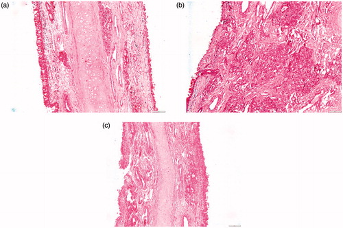 Figure 5. Photomicrographs of the posterior segments of sheep nasal mucosa treated with pH 6.4 PBS (negative control, a), isopropyl alcohol (positive control, b), and CZ-loaded polymeric micelles (c) (100×).