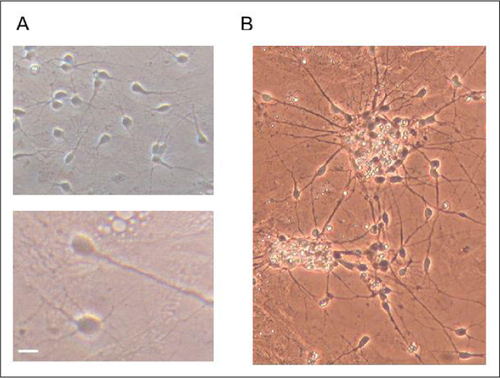 Figure 5. Adult neurons in culture.Brain cells from the striatum of 1-year-old bl6 mice were cultured as described. (A, top) Neuronal growth of dispersed striatal cultures containing both neurons and glia after 20 days in culture. (A, bottom) Magnification (2×) of the same cultures. (B) Some neuronal death can occur after medium replacement and is observed as bright bodies. Scale bar indicates 20 µm. Cell images were taken by a digital camera mounted on a Nikon TMS-12807 microscope with a 20× lens.