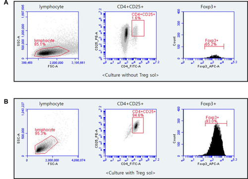 Figure 1 Flow cytometry of CD4+CD25+Foxp3+Treg cells that cultured after depletion of CD8+ T cells from PBMCs. CD8+T cells were eliminated from PBMCs by MACS separation methods. CD4+CD25+ Treg cells were incubated with Treg sol in KBM502 medium. After 14 days, Cultured Treg cells were analyzed by BD Accuri TM C6 Plus. (A) Portion of CD4+CD25+Foxp3+ cells after 14 days of culture without Treg sol in KBM502. (B) Portion of CD4+CD25+Foxp3+ Treg cells after 14 days of culture treated with Treg sol in KBM502.