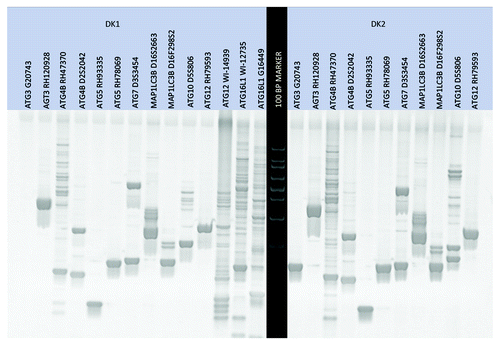 Figure 3. An initial test gel was run to qualify the primer sets and visualize the banding size/pattern.