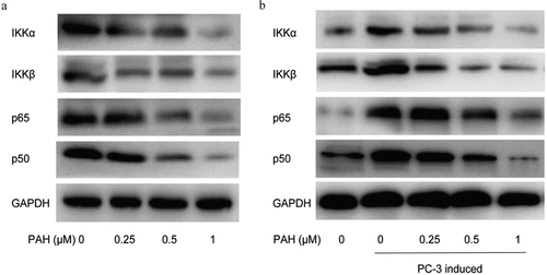 Figure 6. PAH inhibits PC-3 cell- and RANKL-induced activation of NF-κB via suppression of IKK dose-dependently. (a) Protein lysates of PC-3 cells pretreated with various concentrations of PAH (0, 0.25, 0.5, 1 μM) were subjected to western blot analyses with antibodies against mediators of the NF-κB pathway IKKα and IKKβ and NF-κB subunits p65 and p50. (b) PC-3 cells were treated with PAH (0, 0.25, 0.5, 1 μM) for 24 h, incubated with anti-RANKL antibody (0.5 mg/ml) or mouse IgG (0.5 mg/ml), and then the conditioned medium was collected. RAW264.7 cells were cultured in the above conditioned medium of PC-3 cells for 7 days, protein lysates of RAW264.7 cells were subjected to western blot analyses with IKKα and IKKβ, p65 and p50 antibodies. Abrreviations: PAH, perillaldehyde; IKK, inhibitor of nuclear factor kappa B (IκB) kinase.