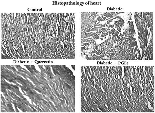 Figure 8. Light microscopic appearance of the heart sections stained with haematoxylin and eosin (magnification 40×). Group – Control: Heart of control rat showing normal myocardial fibres with normal cell structure. Group – Diabetic: Heart of diabetic rats showing severe necrosis, inflammatory infiltration, oedema with degeneration. Group – Diabetic + Quercetin: Quercetin treatment improved the myocardial degeneration with mild inflammatory infiltration when compared to the heart of diabetic rats. Group – Diabetic + Extract: Administration of PGEt also improved the myocardial degeneration when compared to diabetic control.