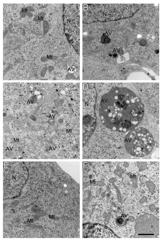 Figure 6. Electron micrograghs of autophagic vacuoles in RA-differentiated SH-SY5Y cells. Vector-transfected (A, C and E) and APPswe (B, D and F) cells were cultured in normoxia (A and B), hyperoxia (C and D), or hyperoxia combined with 3MA exposure (E and F), respectively. Exposure to hyperoxia dramatically increased the number and size of autophagic vacuoles in all cell lines, especially in APPswe cells. This effect of hyperoxia was prevented by 3MA (1 mM). AV, autophagic vacuoles; Mt, mitochondria; N, nucleus. Bar, 1 μm. n = 3.
