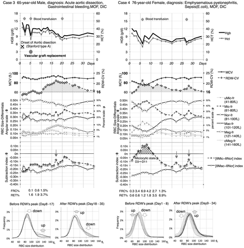 Figure 3. Notes: Time-series investigation of anemic pathogenesis in disseminated intravascular coagulation (DIC) using the XE-5000 analyzer.Clinical problem: The patients in both cases developed DIC from different pathologies, but their anemias were similar and seemed likely related to shortened RBC lifespan due to massive bleeding in Case 3 and extravascular hemolysis in Case 4. Main Relevant Results from Superimposed RBC Size Distributions: [“-fr”=“fraction”]. Case 3: From Day 8 to 17, Meg-fr increased, whereas Nor-fr decreased; from Day 18 to 35, Nor-fr increased, and Meg-fr decreased. Case 4: From Day 1 to 8, uMic-fr and Mic-fr increased, whereas Nor-fr decreased; from Day 9 to 34, Nor-fr and Mac-fr increased, and uMic-fr and Mic-fr decreased conversely. Inferred clinical significance of time-series differential indices: The RDW elevations can be explained by an increase in the θMeg index in Case 3, which suggests an early response of erythropoiesis to severe anemia. By contrast, the early presence of the microcytic state of [θMic−θNor] > 0π and subsequent increase in θMeg index might underlie the RDW elevation in Case 4. This short microcytic state in Case 4 may suggest RBC fragmentation concurrent with blood transfusion because of the appearance of helmet cells in blood smear tests in Case 4 but not in Case 3. The down arrows in the [θMic-θNor] index in both cases suggest potential instability of the accuracy, except for the second arrow in Case 4, which was associated with blood transfusion.