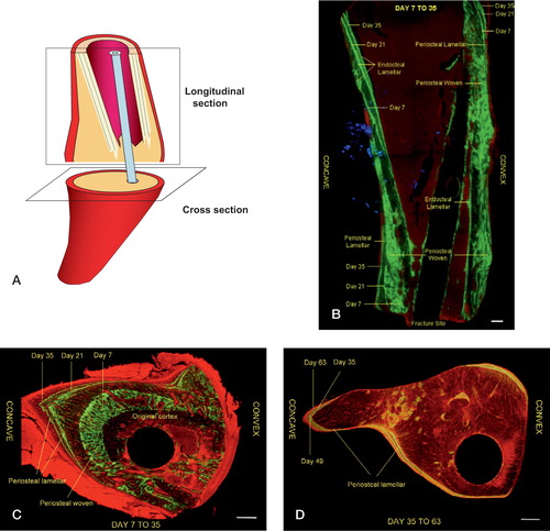 Figure 4. Schematic illustration showing types of tissue sections (A) taken for analysis of bone dye uptake and fluorescence photomicrographs of mineralization over time.In the longitudinal section (B:proximal diaphysis) and cross-sections (C and D:fracture level) in the angulated group, the lines denote origin (endosteal vs.periosteal) and type (woven vs.lamellar) of new bone formation.Green staining represents the uptake of calcein and red staining the uptake of Alazerin.Day refers to the day of injection of calcein. Bar represents 0.5 mm.