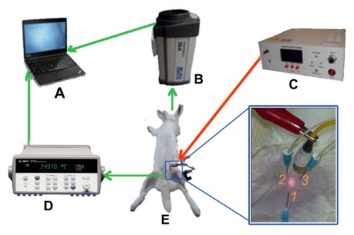 Figure 3 Schematic representation of the in vivo animal experiment. The rabbit (E) was anesthetized with isoflurane and hair was removed from its leg. The diode laser system (C) was used to emit laser radiation as a heating source. The infrared camera (B) recorded the thermal images of the heated materials in real time and the internal temperature was monitored by thermocouple thermometer (D). The depth of thermocouple 1 was 3 mm in the center of the laser pot and the depths of thermocouples 2 and 3 were 1 cm and 0.5 cm beside the pot of the laser, respectively. The thermal images and internal temperature data were shown on the laptop computer (A).